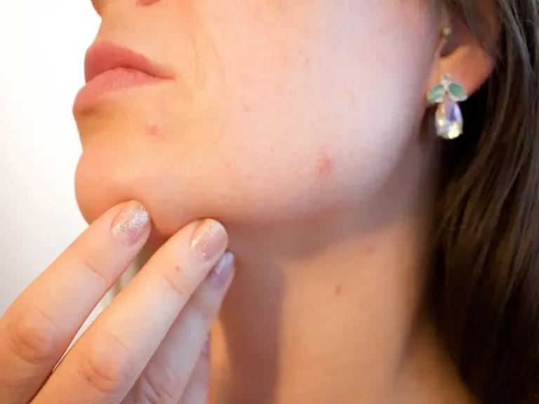 10 Essential Skincare Tips to Minimize Pores