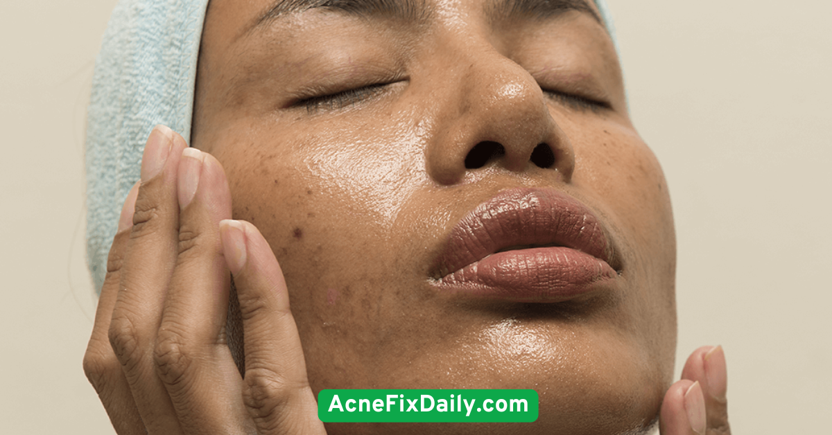 Avoid Heavy Creams and Oils on Oily Areas