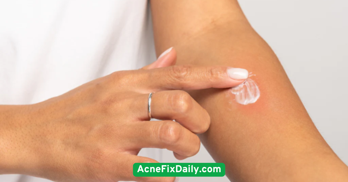 Patch-Test New Products Religiously