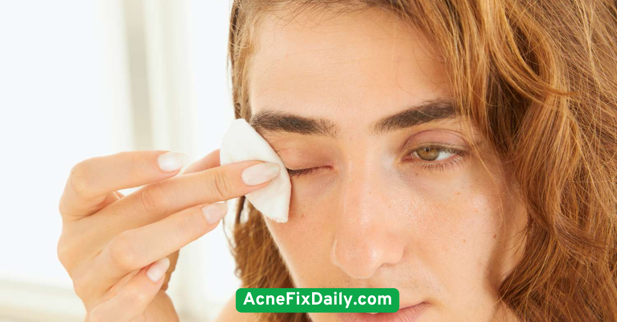 Use gentle makeup removers