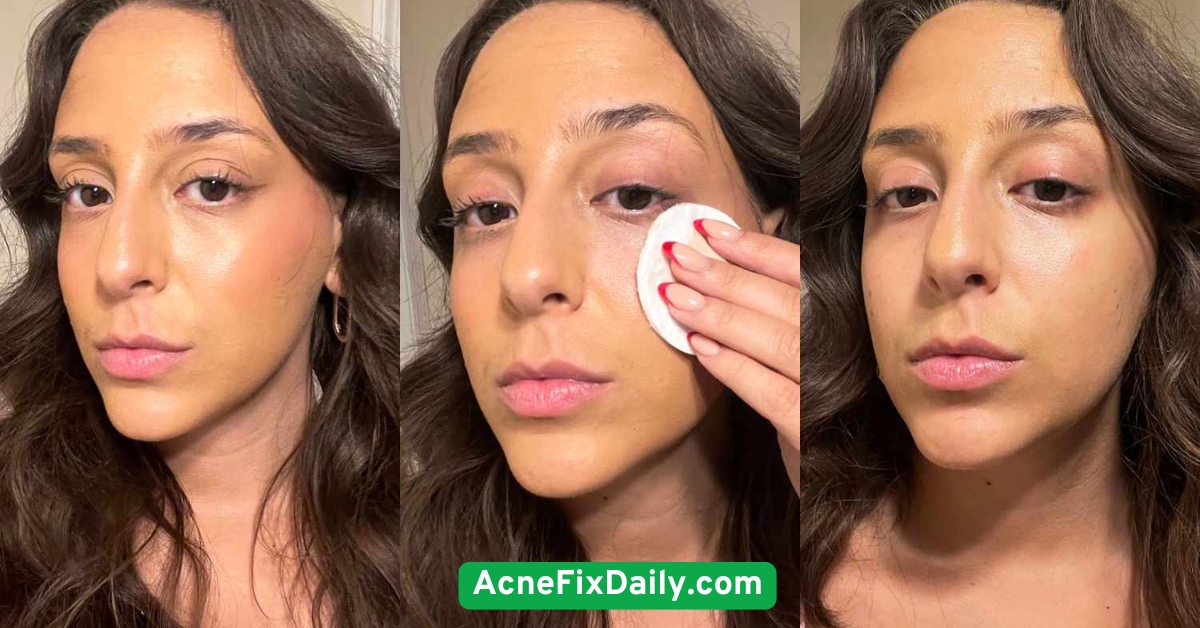 Use Gentle Makeup Removers