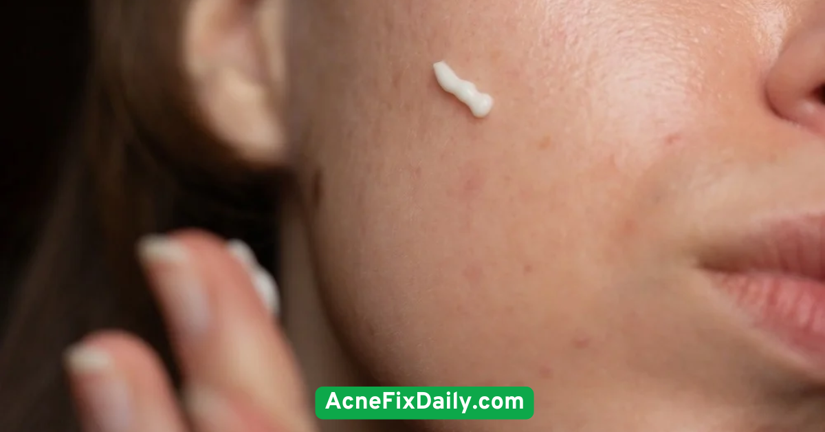 Use a Retinol or Retinoid