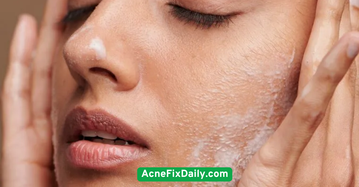  Use a Salicylic Acid Cleanser