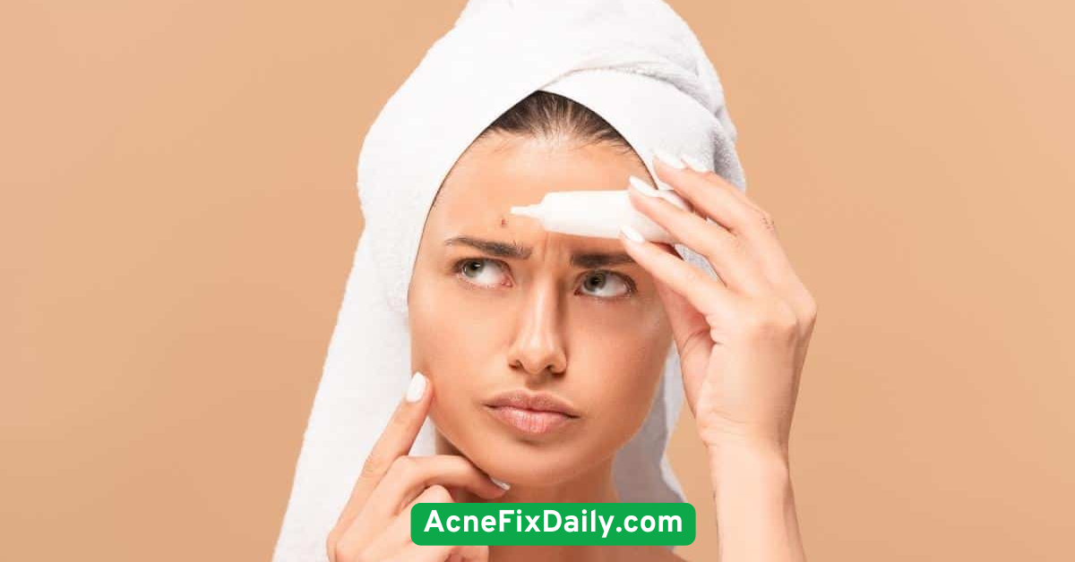 Apply Targeted Acne Treatments with Care