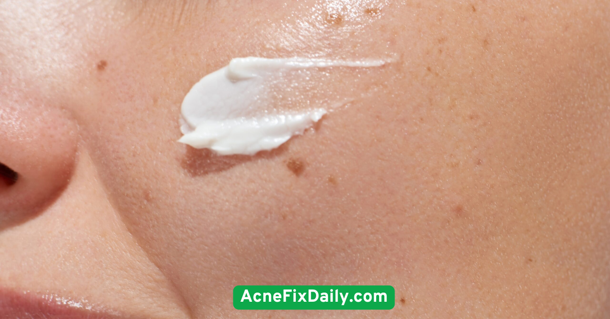 Moisturize with a Lightweight, Non-Comedogenic Cream